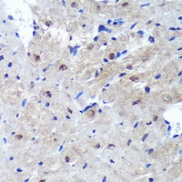 PSME4 Rabbit Polyclonal Antibody