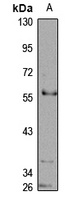 PTPN18 Rabbit Polyclonal Antibody
