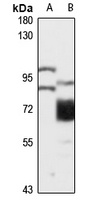 PUS7L Rabbit Polyclonal Antibody