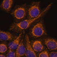 PYCR2 Rabbit Polyclonal Antibody