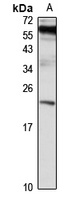 RAB10 Rabbit Polyclonal Antibody