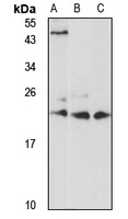 RAB1A Rabbit Polyclonal Antibody