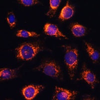 RAB1A Rabbit Polyclonal Antibody