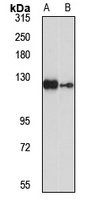 RABGAP1 Rabbit Polyclonal Antibody