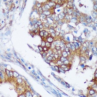 RABGAP1 Rabbit Polyclonal Antibody