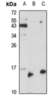 RABIF Rabbit Polyclonal Antibody