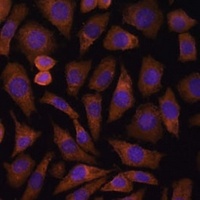 RABIF Rabbit Polyclonal Antibody