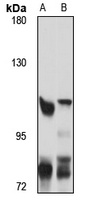RAD54B Rabbit Polyclonal Antibody