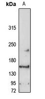 RASAL2 Rabbit Polyclonal Antibody