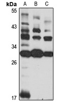 RASD1 Antibody