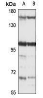 RBM10 Rabbit Polyclonal Antibody
