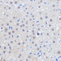 RBM39 Rabbit Polyclonal Antibody
