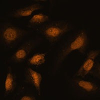 RBM39 Rabbit Polyclonal Antibody