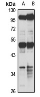 RBMS1 Rabbit Polyclonal Antibody