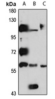 RCBTB2 Rabbit Polyclonal Antibody