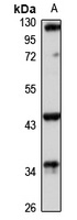 RGMA Rabbit Polyclonal Antibody