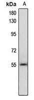 RGS3 Rabbit Polyclonal Antibody