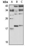 RGS8 Rabbit Polyclonal Antibody