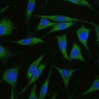 RHBDD1 Rabbit Polyclonal Antibody
