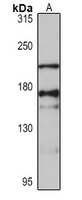RNF17 Rabbit Polyclonal Antibody