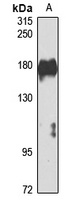 RPGRIP1 Rabbit Polyclonal Antibody