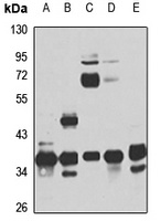 RPRD1B Rabbit Polyclonal Antibody