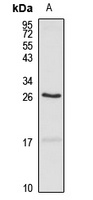 RTN3 Rabbit Polyclonal Antibody