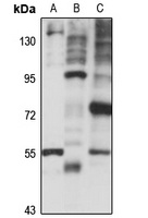 RUSC1 Rabbit Polyclonal Antibody