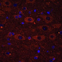 RUSC1 Rabbit Polyclonal Antibody