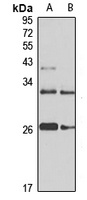 SAR1A Rabbit Polyclonal Antibody
