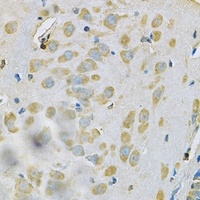 SAR1A Rabbit Polyclonal Antibody