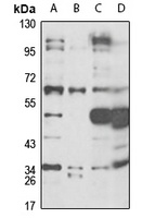 CD36 Rabbit Polyclonal Antibody
