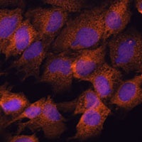 SCRN3 Rabbit Polyclonal Antibody