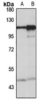 SEC24C Rabbit Polyclonal Antibody