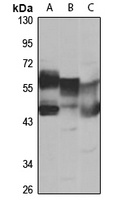SESN2 Rabbit Polyclonal Antibody