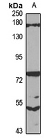 SFI1 Rabbit Polyclonal Antibody
