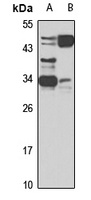 SFRP1 Antibody