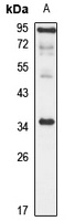 Gamma-sarcoglycan Rabbit Polyclonal Antibody