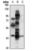 Endophilin-B1 Rabbit Polyclonal Antibody