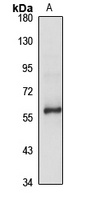 SIM2 Rabbit Polyclonal Antibody