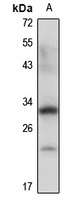 SIX2 Rabbit Polyclonal Antibody