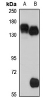 SLC12A1 Rabbit Polyclonal Antibody