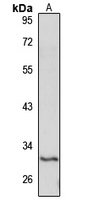 SLC17A5 Rabbit Polyclonal Antibody