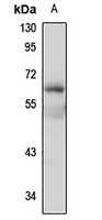SLC17A7 Rabbit Polyclonal Antibody