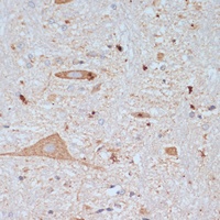 SLC18A3 Antibody