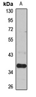 SLC25A19 Rabbit Polyclonal Antibody