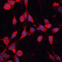SLC25A19 Rabbit Polyclonal Antibody