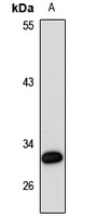 SLC25A38 Rabbit Polyclonal Antibody