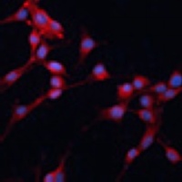 SLC25A38 Rabbit Polyclonal Antibody