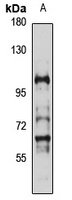 SLC26A6 Rabbit Polyclonal Antibody